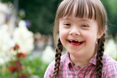 روش درمانی موثر برای کودکان مبتلا به سندرم داون